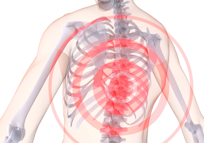 A csontok és ízületek gerinc deformációjának görbülete osteochondrosis